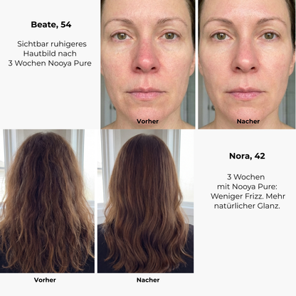 Pure® Premium Filterduschkopf – Für spürbar weiche Haut, glänzendes Haar